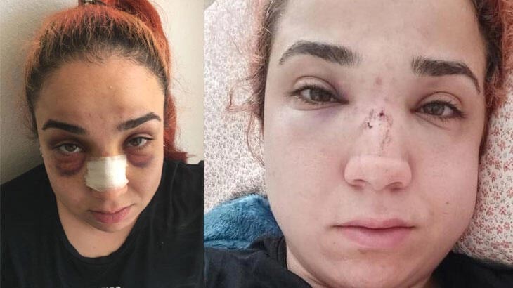 Tek kelimeyle vahşet! Patronu bu hale getirdi