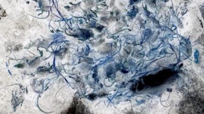 Dehşete düşüren olay! Gözünü kemirirken uyandı!