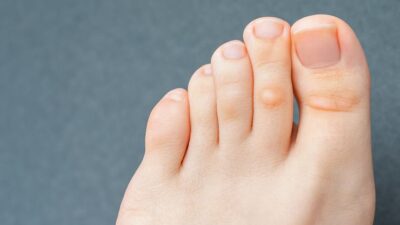 Hemen kontrol edin! İkinci parmağınız uzunsa…