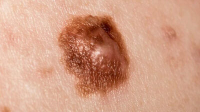 Bu 5 sinyale dikkat!