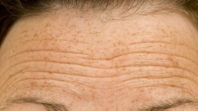 Gençleştiriyor! Yaşlanmayı yavaşlatıyor…