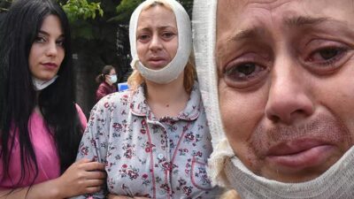 Köpek beslerken saldırıya uğrayan kadın: Tek suçum hayvanları doyurmak