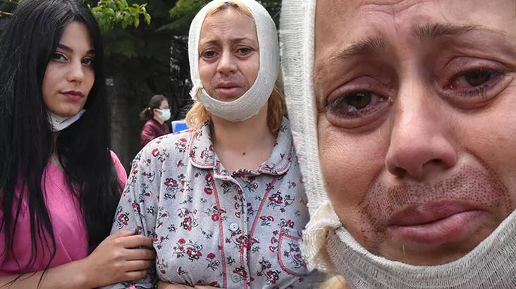 Köpek beslerken saldırıya uğrayan kadın: Tek suçum hayvanları doyurmak