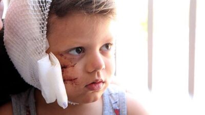 Köpeğin saldırdığı küçük Yağız ölümden döndü