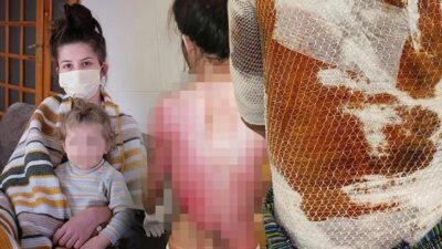 Kaynar su dehşetine iyi hal indirimli 3 yıl 9 ay hapis