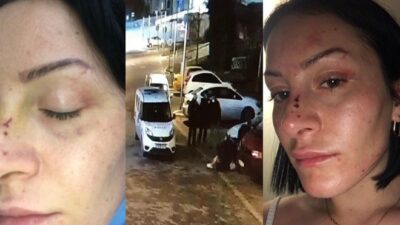 Polisten kadına dayak iddiası: Doktor az bile benzetmişsiniz dedi