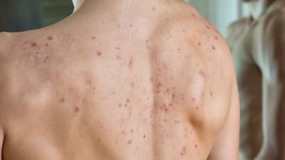 En sinsi belirtisiymiş!