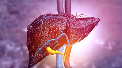 Karaciğer yağlanmasını anında geçiriyor!