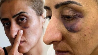 Bu sese kulak ver! ‘Ensemde ölüm kokusu alıyorum’