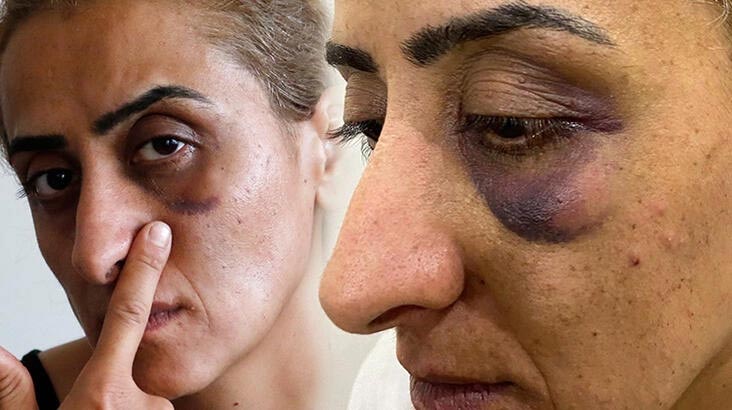 Bu sese kulak ver! ‘Ensemde ölüm kokusu alıyorum’