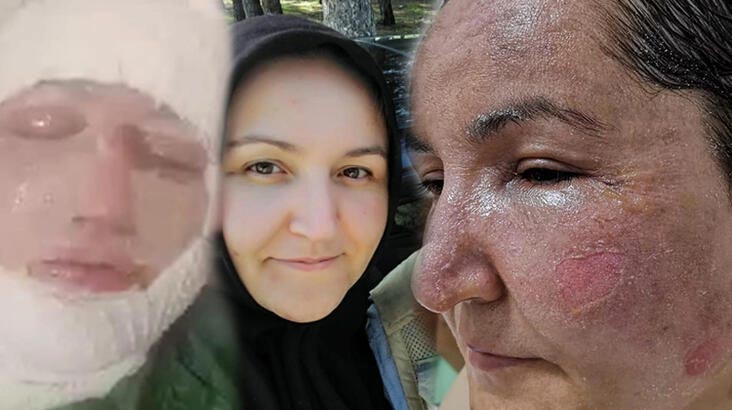 Çocuklarının gözü önünde eşini kızgın yağ ve kaynar su ile haşladı