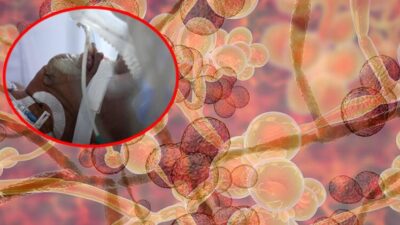 Tedavisi yok! Hızla yayılıyor…