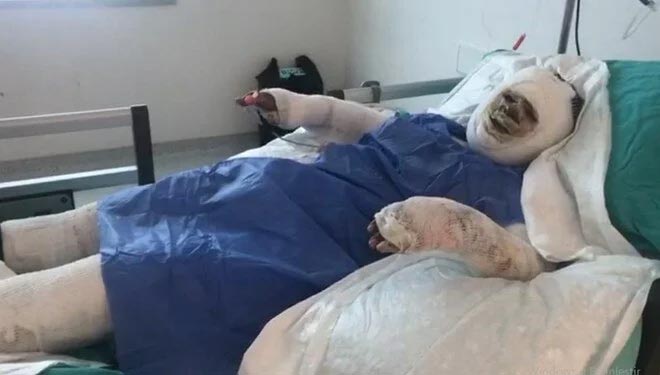 Damat dehşeti! Kayınvalidesini yakıp izledi