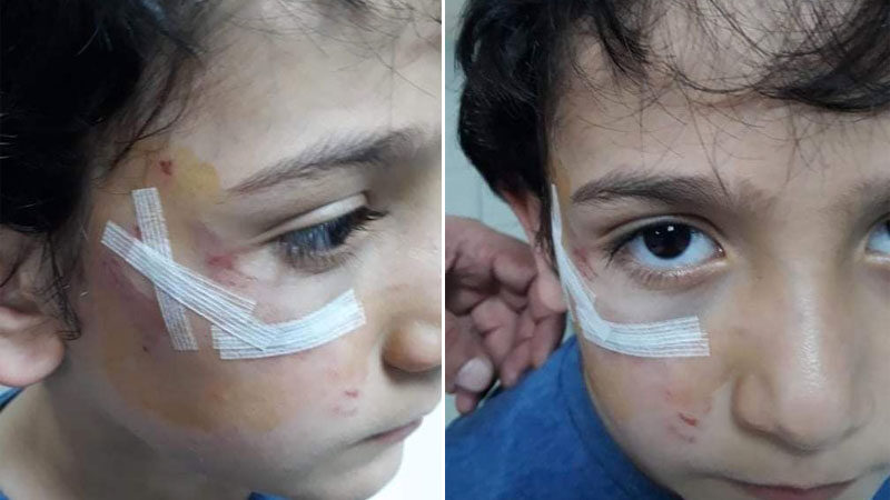 Bursa’da 8 yaşındaki Mehmet dehşeti yaşadı Bursa'nın İznik ilçesinde 8 yaşındaki bir çocuk sokak köpeklerinin saldırısına