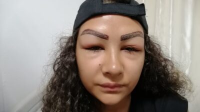 Reklam yüzü olacaktı! Hastanelik oldu!