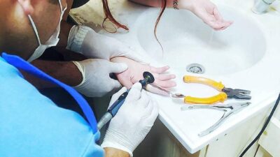 Bursa’da parmağına yüzük sıkışan kadının imdadına itfaiye yetişti