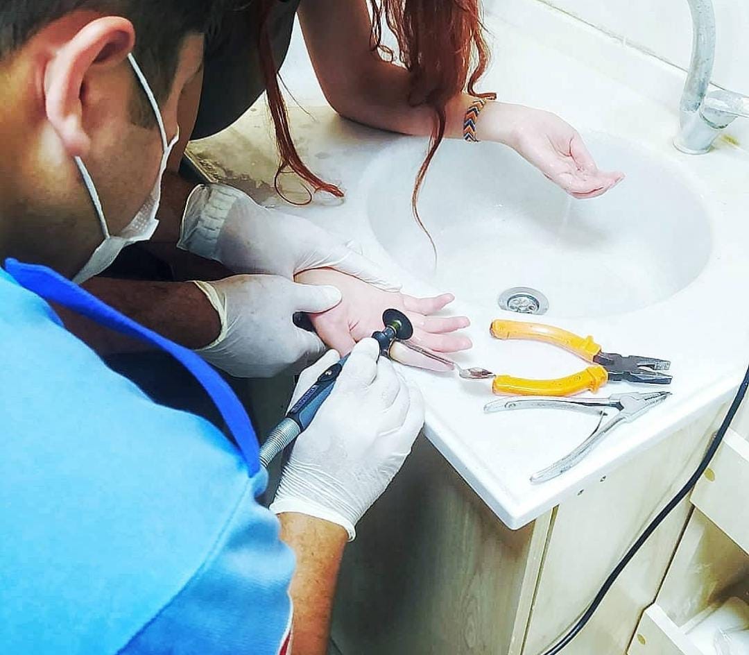 Bursa’da parmağına yüzük sıkışan kadının imdadına itfaiye yetişti