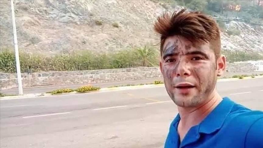 Kahreden detay! Su taşırken alevlerin arasında kalmış