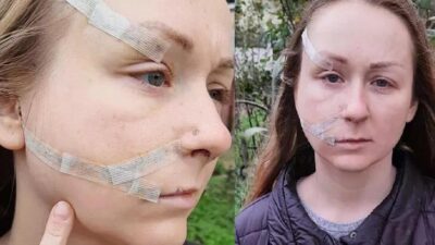 Mahkemede kan donduran sözler! ‘Yüzümün yarısı elimdeydi’