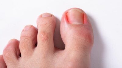 Bu belirtilere dikkat! Bağışıklık sisteminin…