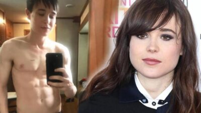 Cinsiyet değiştirerek erkek olmuştu! Ameliyat izi dikkat çekti!