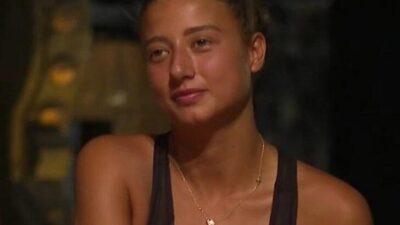 Estetik sonrası hali şaşırttı