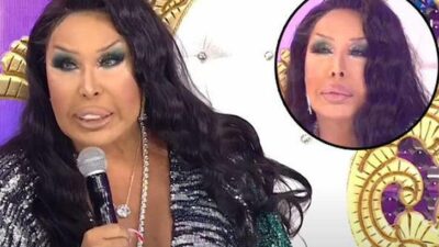 Bülent Ersoy’un yüzündeki değişimin sebebi estetik değilmiş!