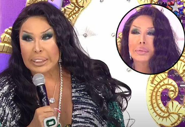 Bülent Ersoy’un yüzündeki değişimin sebebi estetik değilmiş!