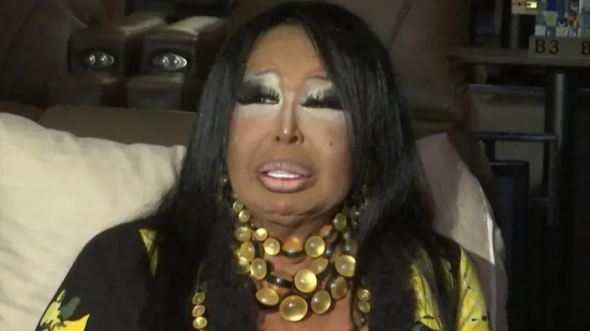 Bülent Ersoy’u kahreden haber! Başından ayrılmıyor