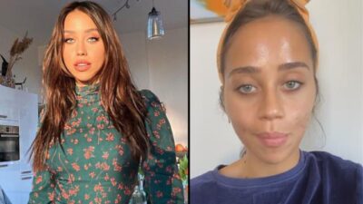 Hamdi Alkan’ın kızından şoke eden açıklama! ‘Özgüvenim sıfır, dışarı çıkamıyorum’