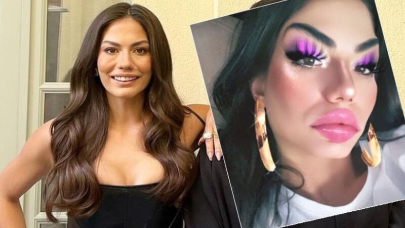 Daha önce yüz yogasına başladığını dile getiren Demet Özdemir, estetik