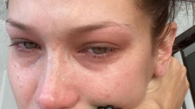 “Ruh sağlığım için bıraktım…”