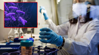 Korkutan uyarı: Ölümcül süper bakteri insanlara geçebilir!