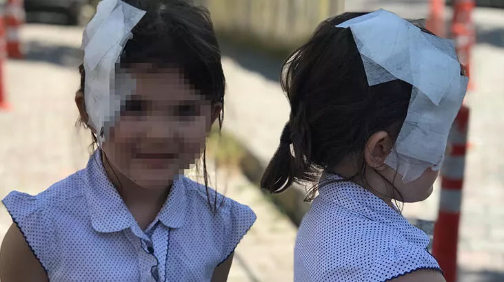 Pitbull saldırısına uğrayan kız çocuğu kafasından yaralandı!