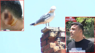 Kavgada ısırılarak koparılan kulağını martı kaptı