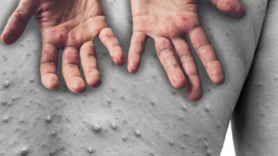 O ilimizi virüs korkusu saldı! Resmi açıklama…