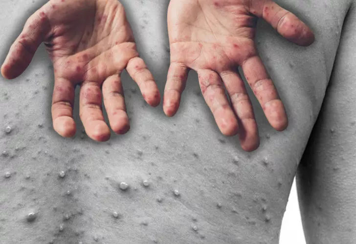 O ilimizi virüs korkusu saldı! Resmi açıklama… O ilimizi virüs korkusu saldı! Resmi açıklama…