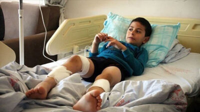 4 köpek birden saldırdı! Baba isyan etti