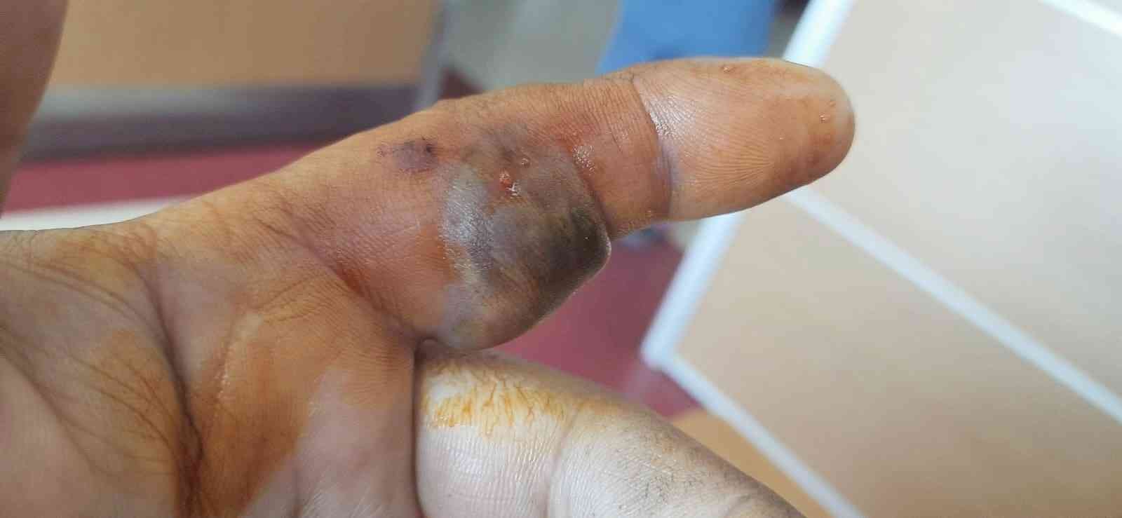 Bursa’da bir adam elini sokan yılanla hastaneye koştu Bursa’da bir adam elini sokan yılanla hastaneye koştu