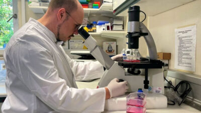 Maymun çiçeği virüsü vakaları bir haftada üçe katlandı