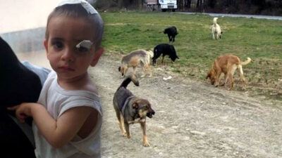 Köpeklerin saldırdığı çocuktan acı haber