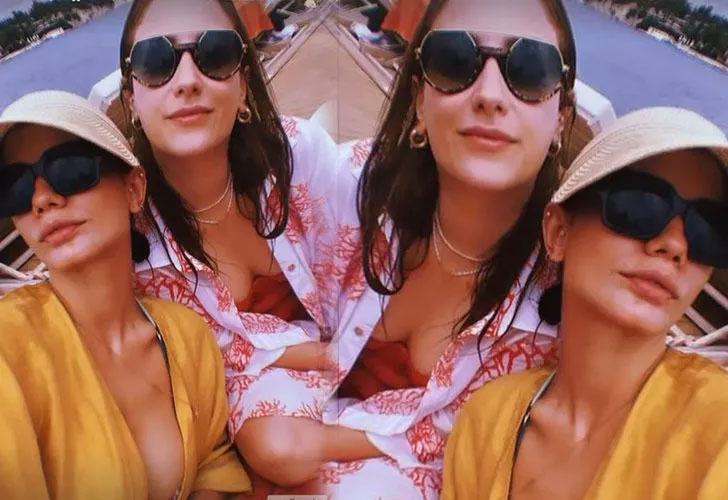Hazal Kaya bikinili ve yanmış halini paylaşıp kendiyle dalga geçti