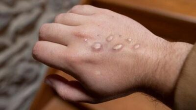 DSÖ, Türk hastayı örnek gösterdi: Durdurulabilir