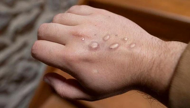 DSÖ, Türk hastayı örnek gösterdi: Durdurulabilir