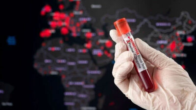 DSÖ: 2 haftada vakalar üçe katlandı