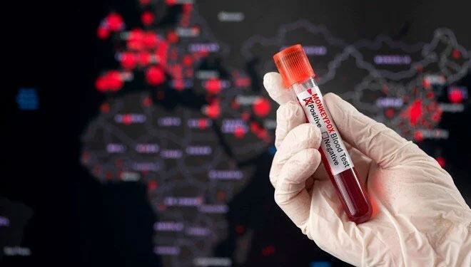 DSÖ: 2 haftada vakalar üçe katlandı DSÖ: 2 haftada vakalar üçe katlandı