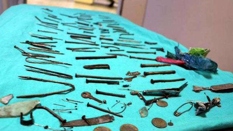 Midesinden çıkanlar şoke etti! Çivi, bıçak, tırnak makası… Midesinden çıkanlar şoke etti! Çivi, bıçak, tırnak makası…