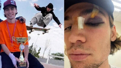 Milli sporcuyu hastanelik ettiler