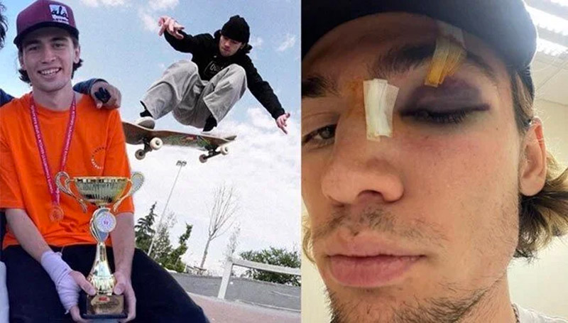 Milli sporcuyu hastanelik ettiler