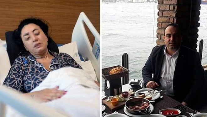 Eski sevgili dehşeti: Midesinin yüzde 30’u alındı, vücuduna 135 dikiş atıldı